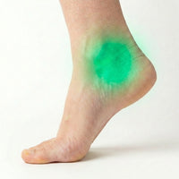 Ankle