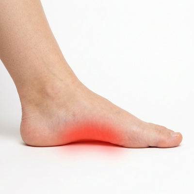 Plantar Fasciitis